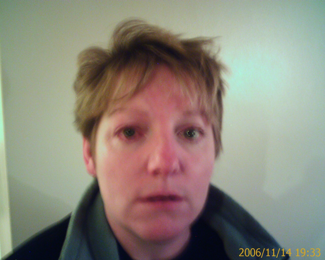 inflamedeye.jpg